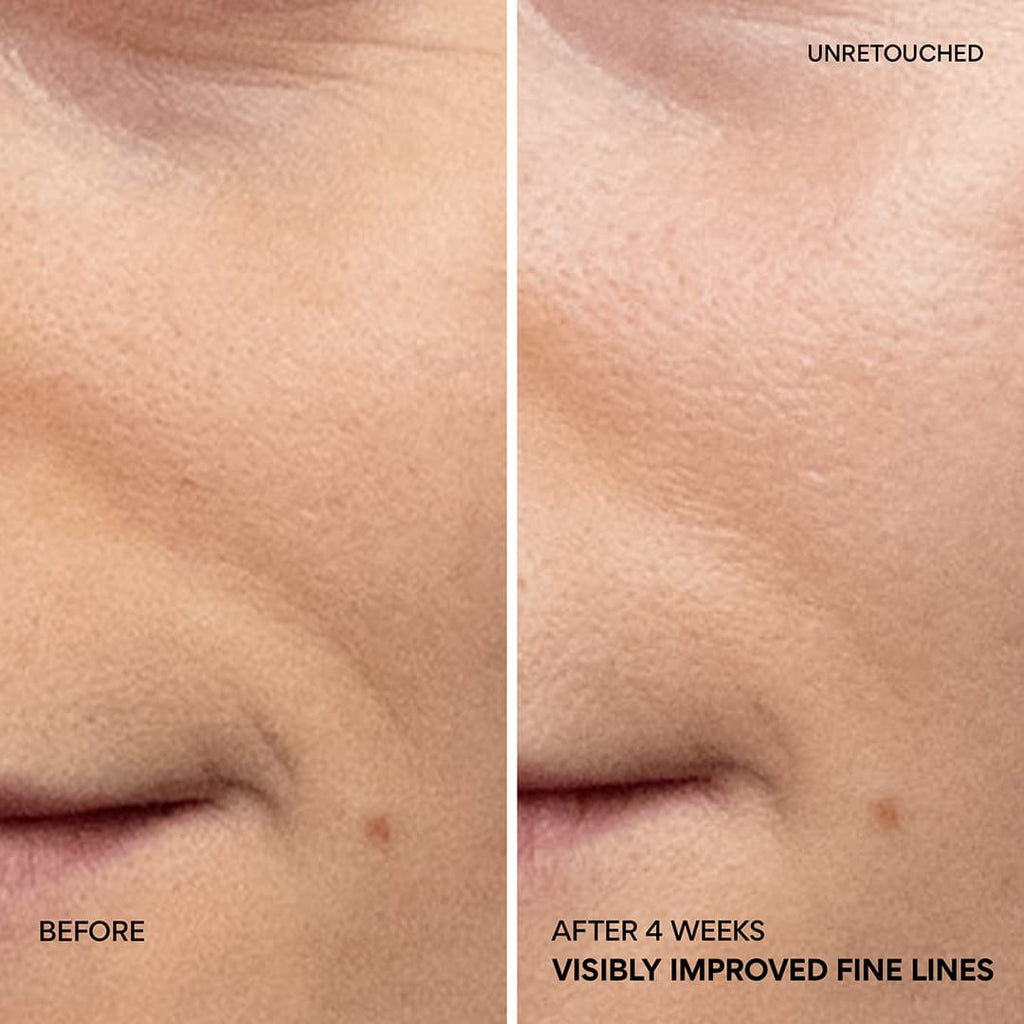 Green Tea PDRN™ Bounce Booster Eye & Lip Serum smile lines before and after