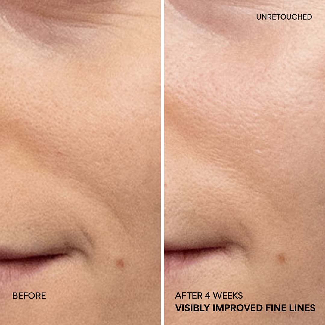 Green Tea PDRN™ Bounce Booster Eye & Lip Serum smile lines before and after