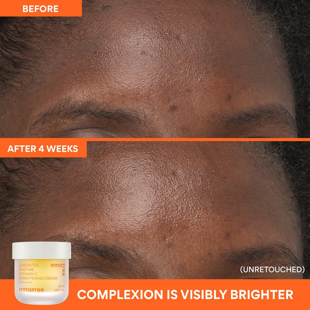 complexion is visibly brighter before and after 4 weeks: Vitamin C Brightening Gel Cream